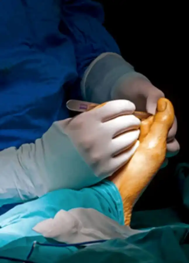 cirugia menor del pie